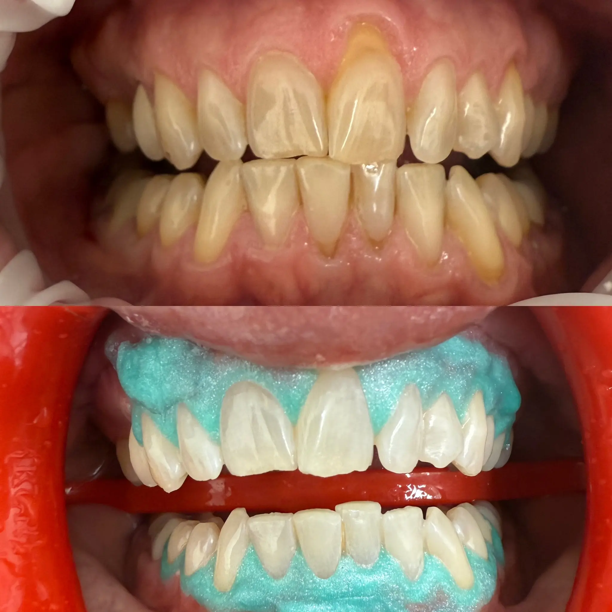 Le Blanc General Dentistry & Aesthetics