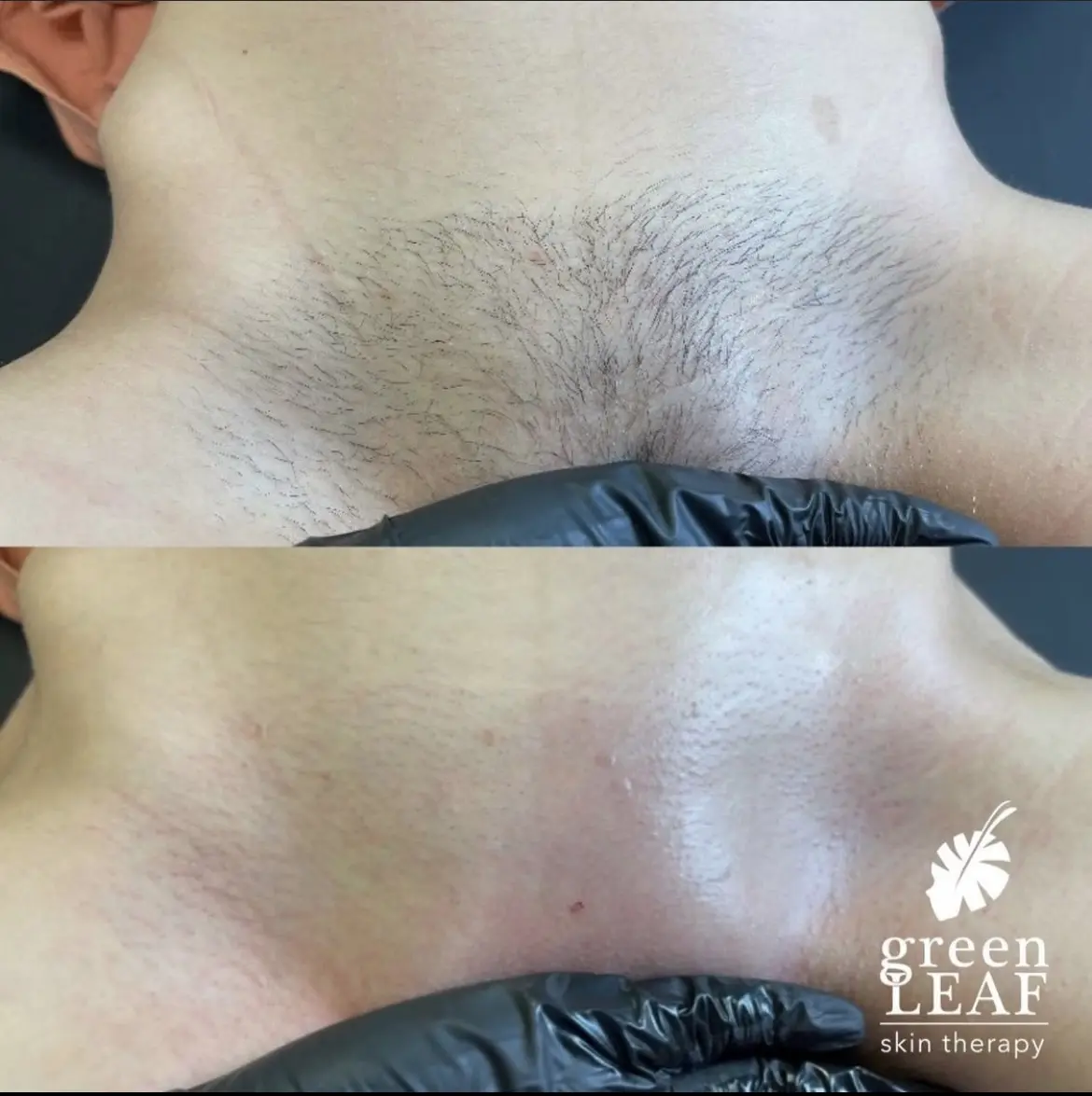 Greenleaf Skin Therapy LLC
