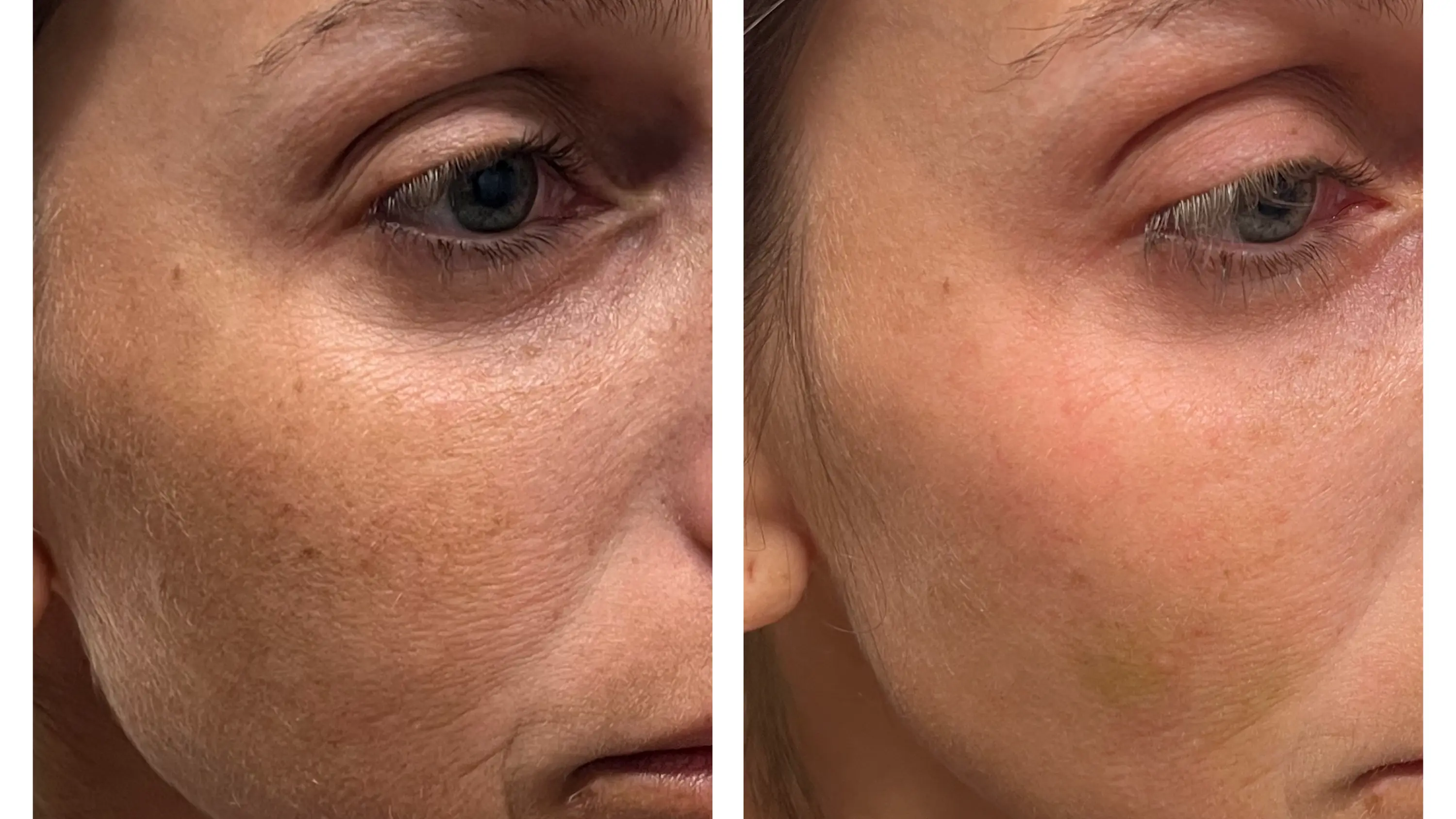 Elevate Skin Clinic and Medspa