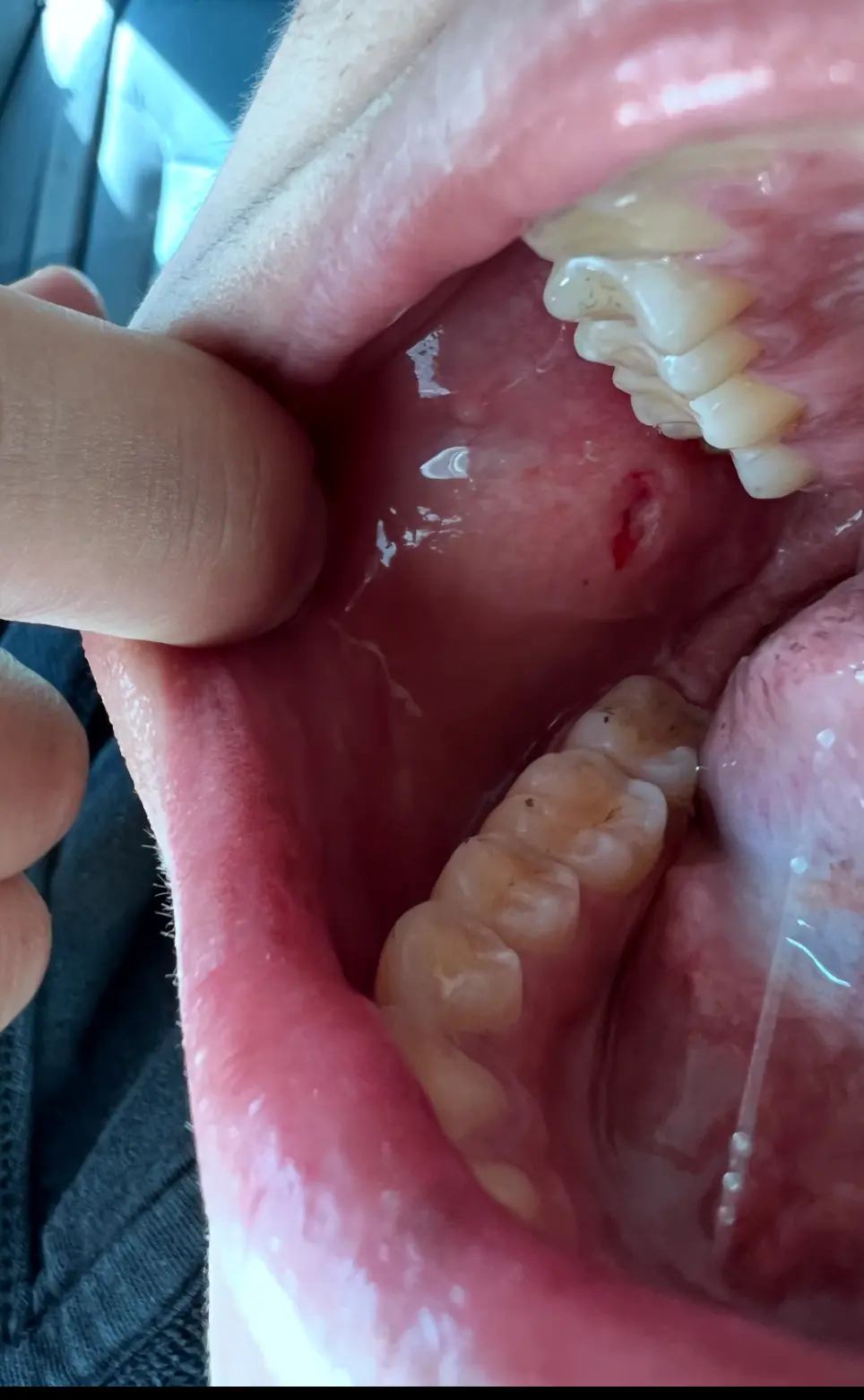 Aspen Dental - San Antonio, TX - Med Center