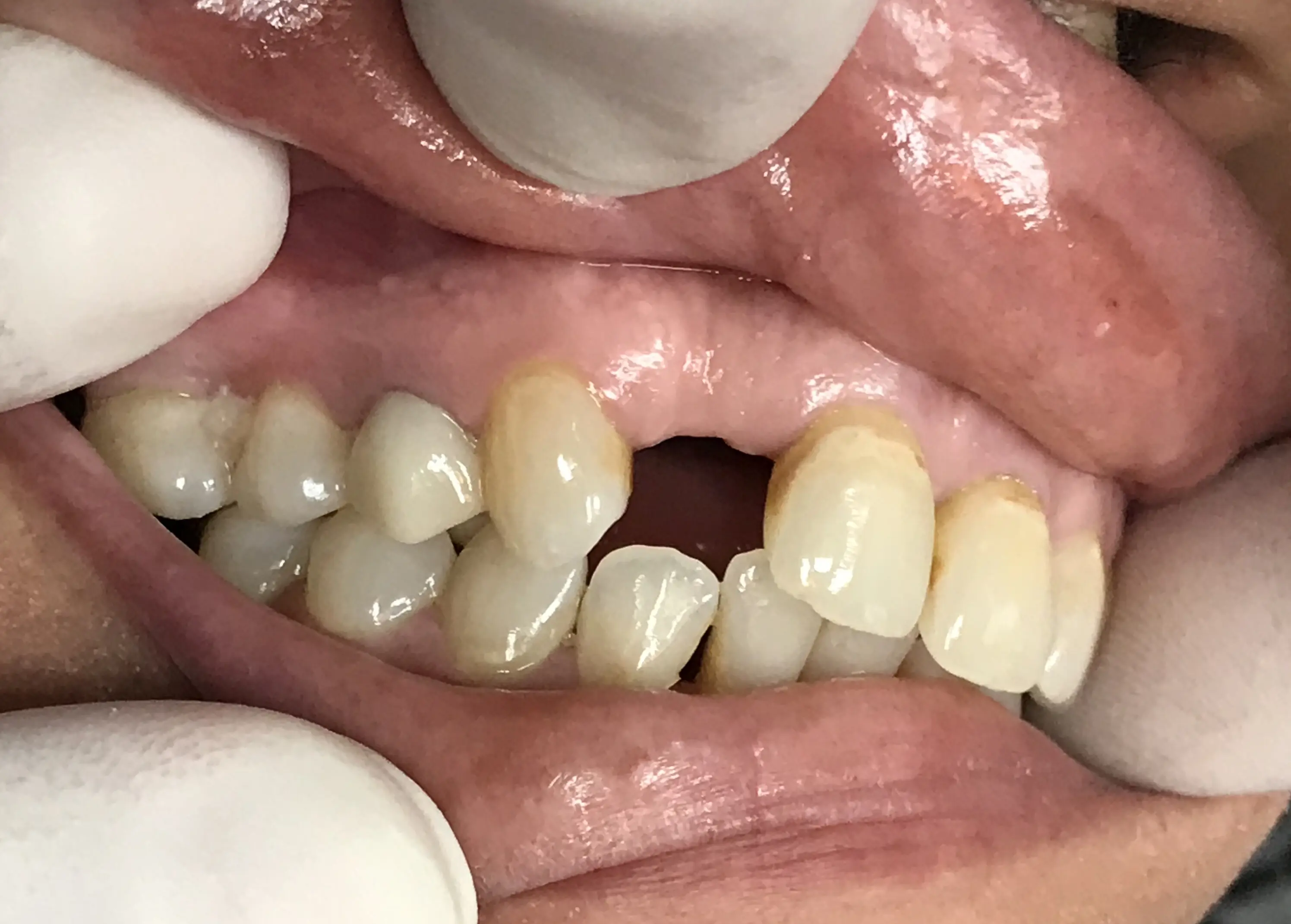 AZ Dental Club - Phoenix ( Dr. Jason Nordean)
