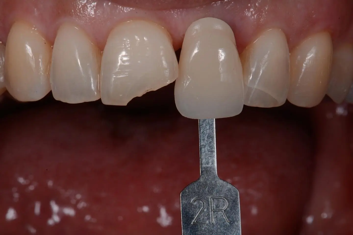 Gallardo Periodontics and Implant Dentistry