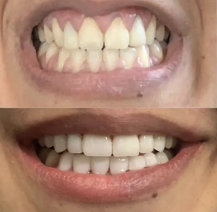 NLV Dental Group