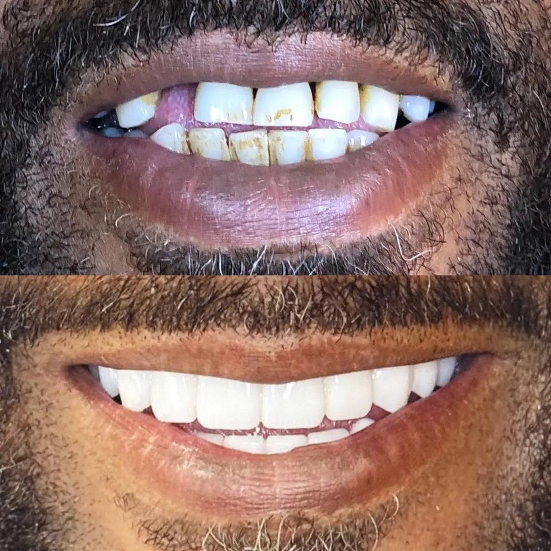 GEMS Dental - CARE Esthetics Houston