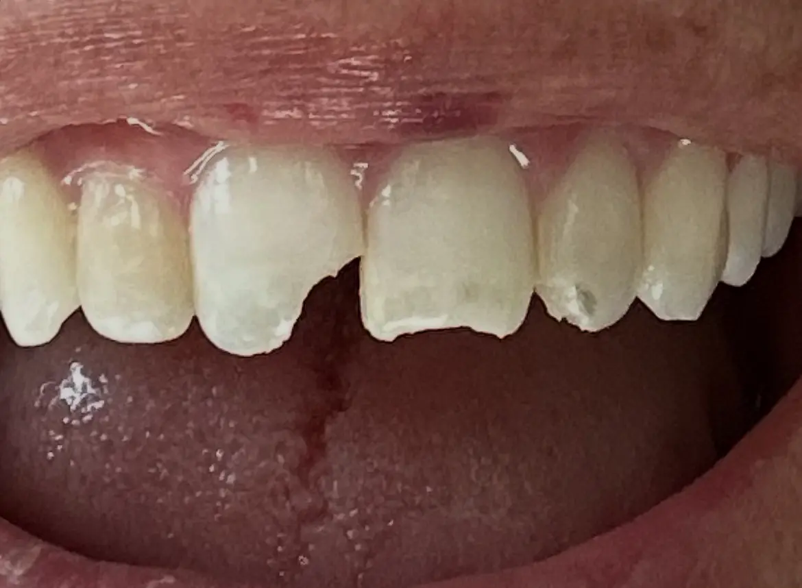 Kimberley Lane Cosmetic and Family Dentistry