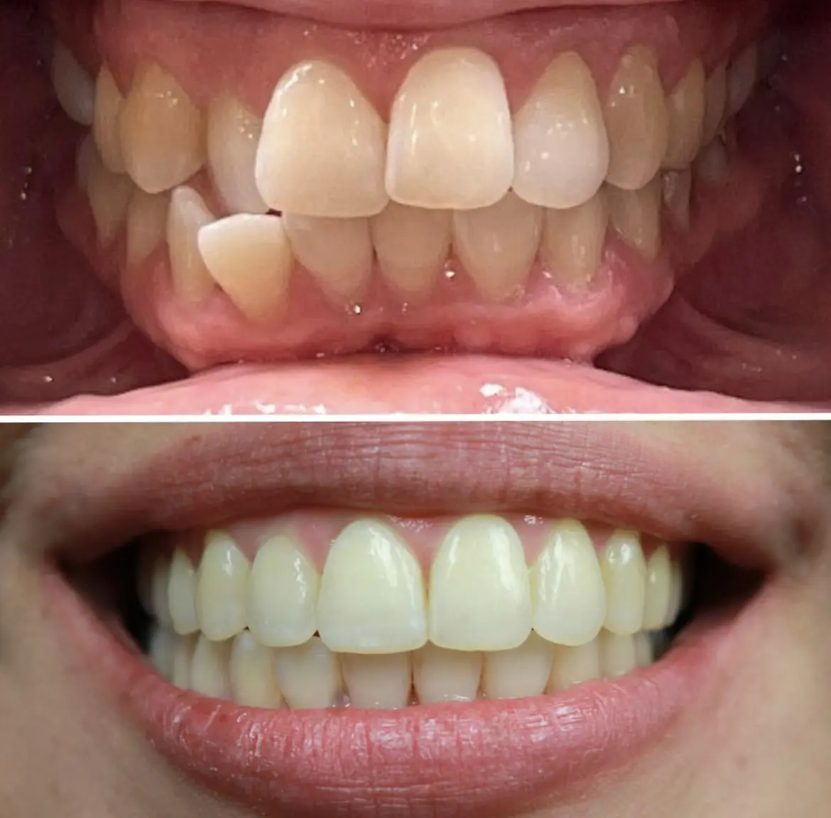 New Heights Dental & Braces