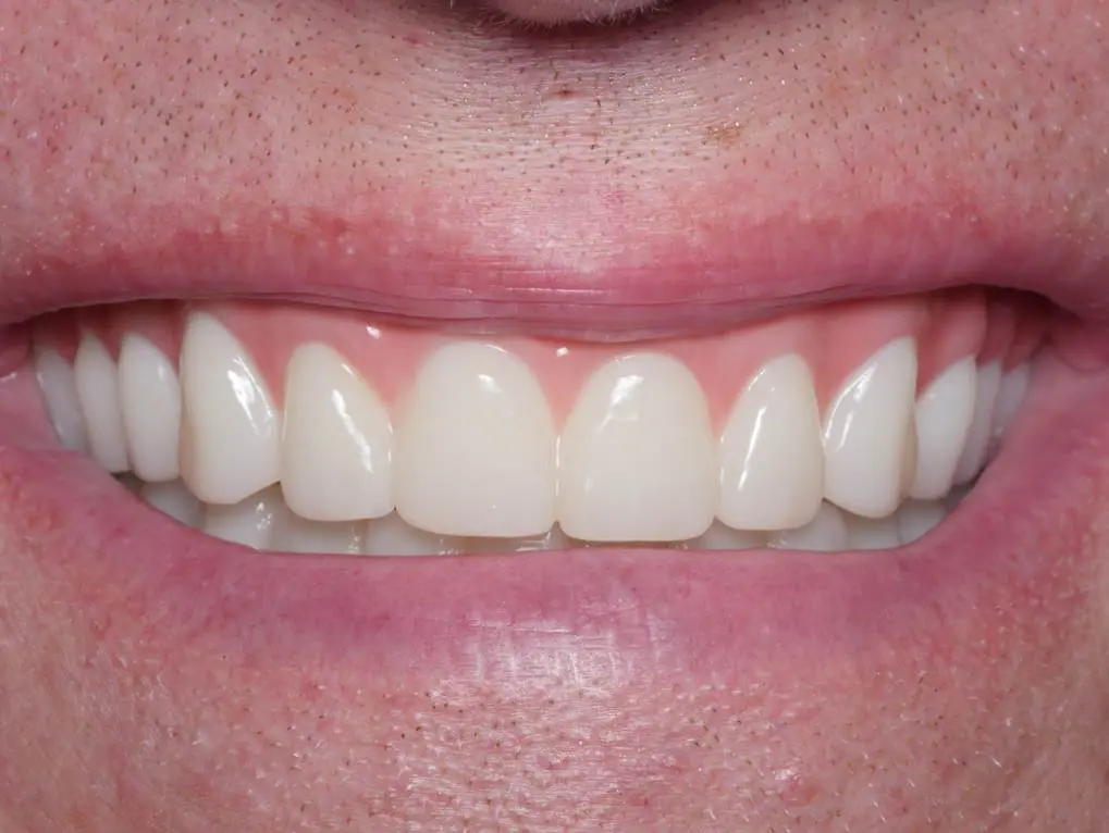 My Dentist in Plano
