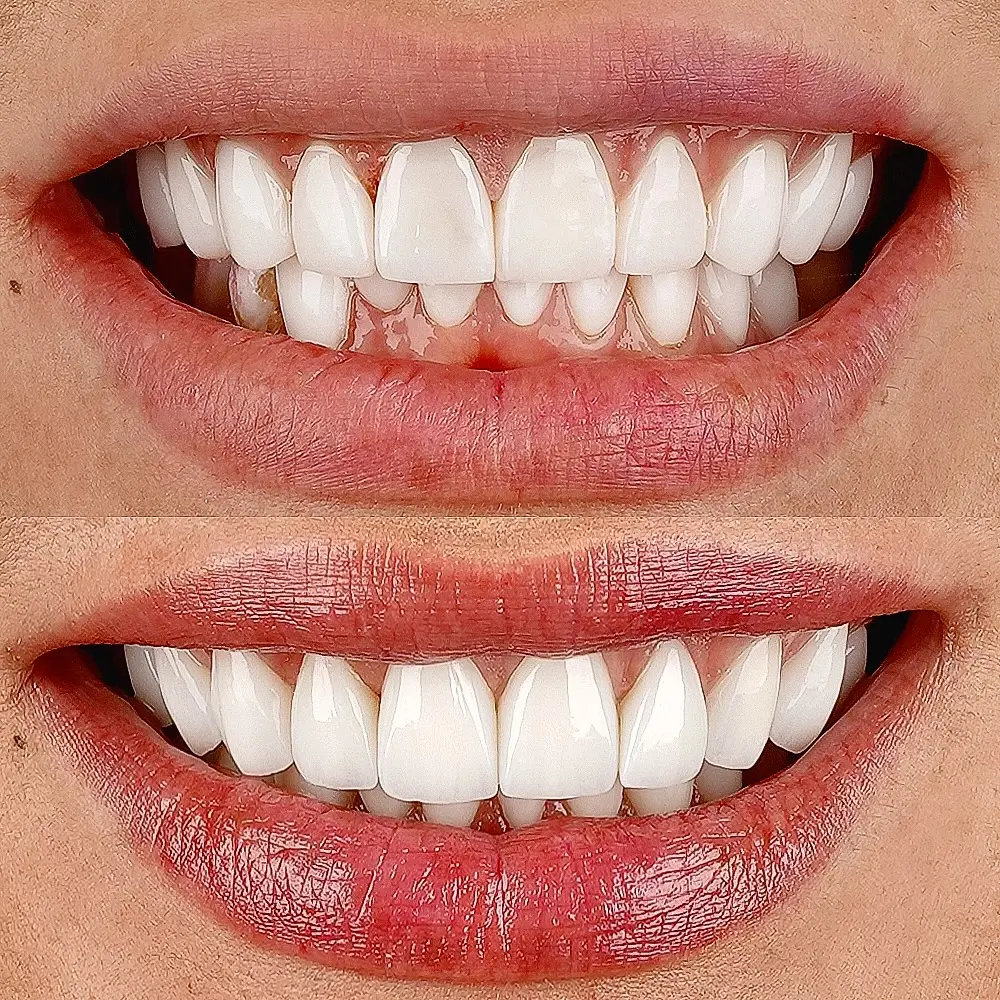 Deluxe Smile Design