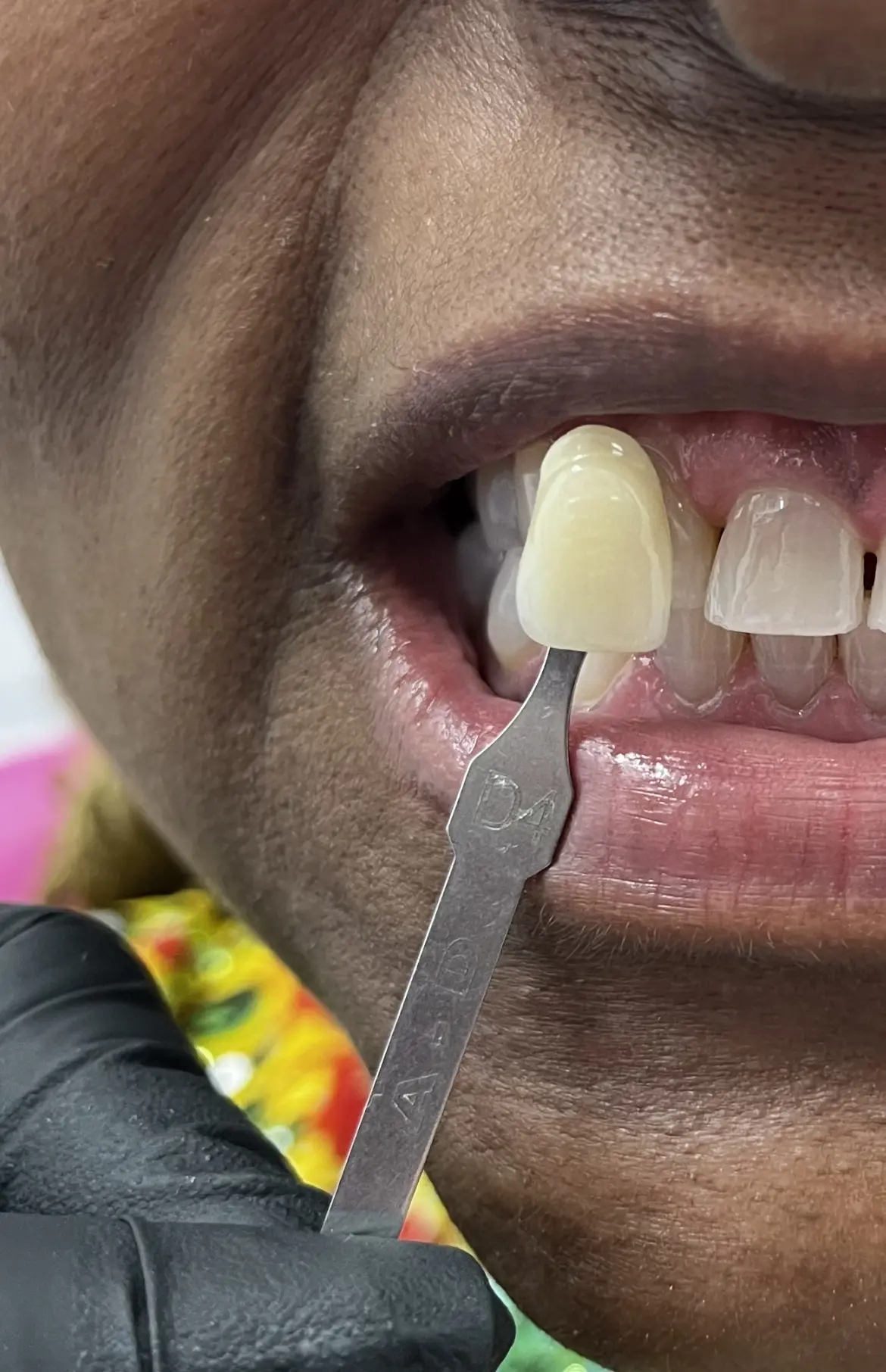 CG Smile