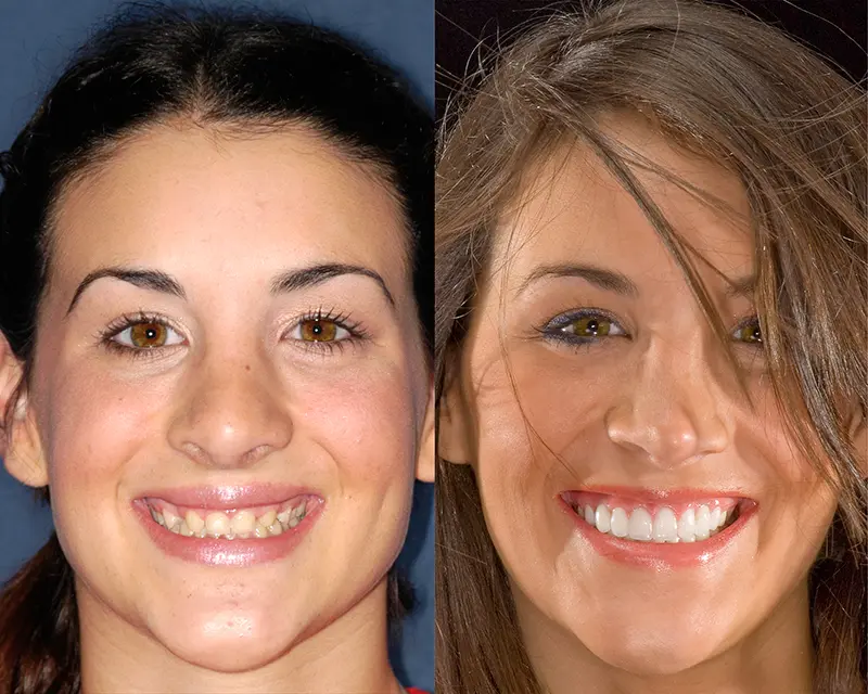 Lutke Dental - Plano, TX