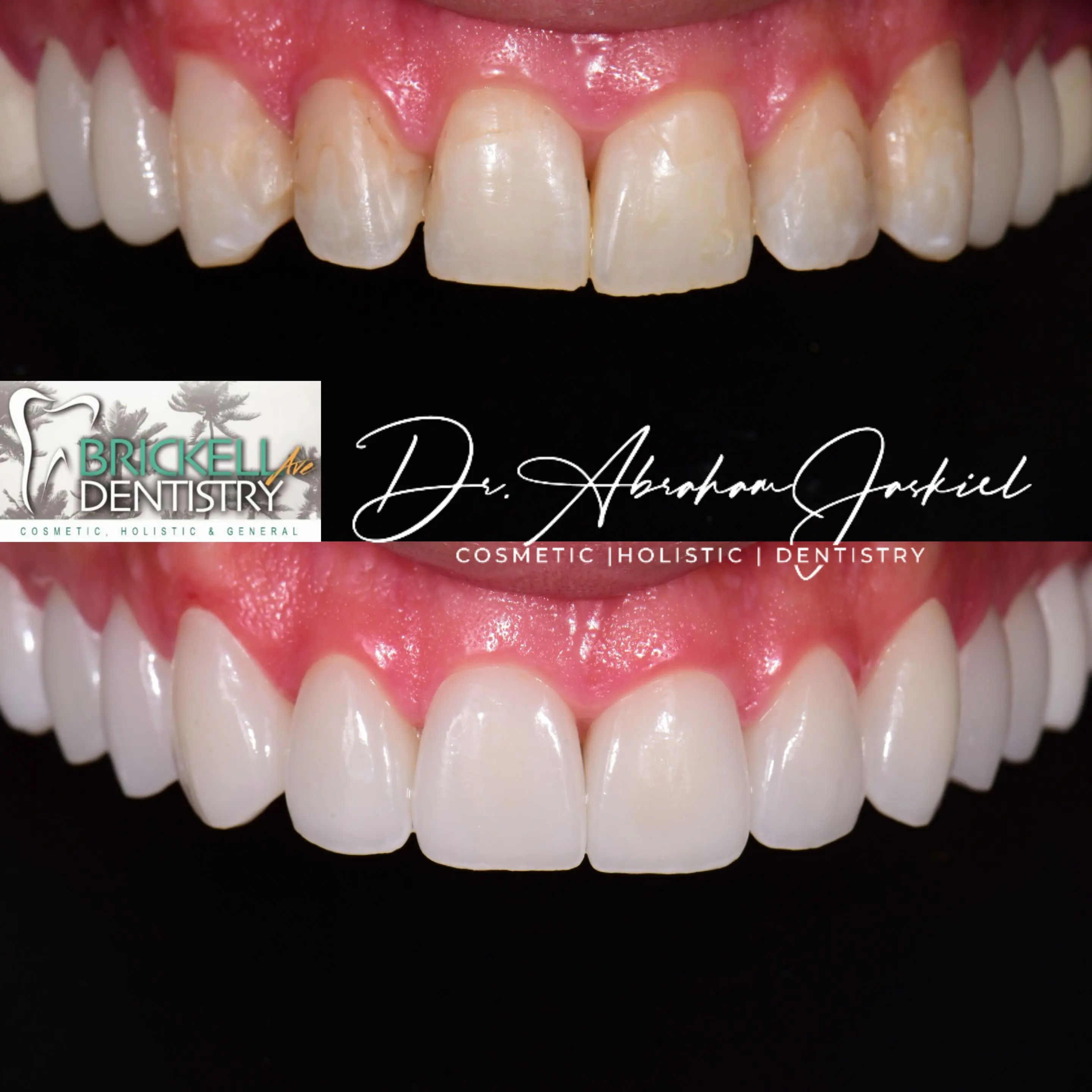 Brickell Avenue Cosmetic & Holistic Dentistry