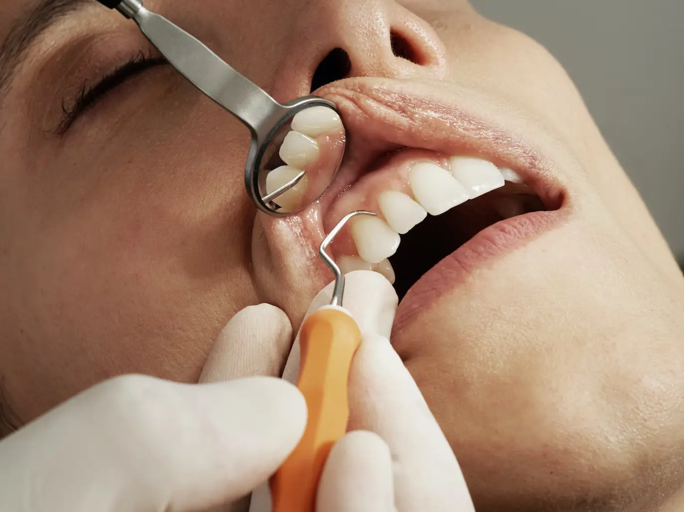 Dentist Las Vegas | Desert Springs Dental Care