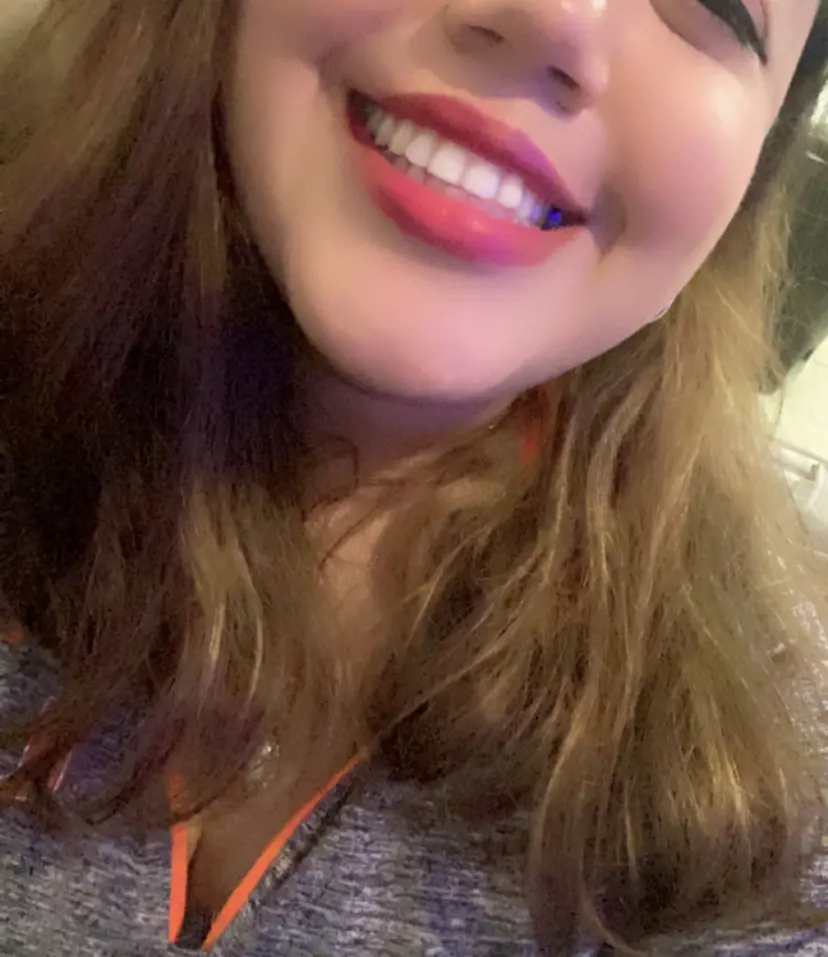 Icy White Teeth Mobile Whitening