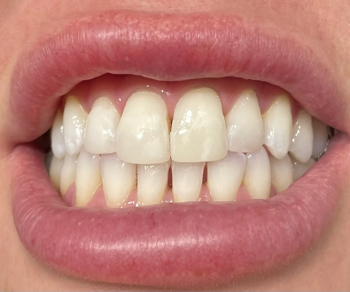 ZipAppointments