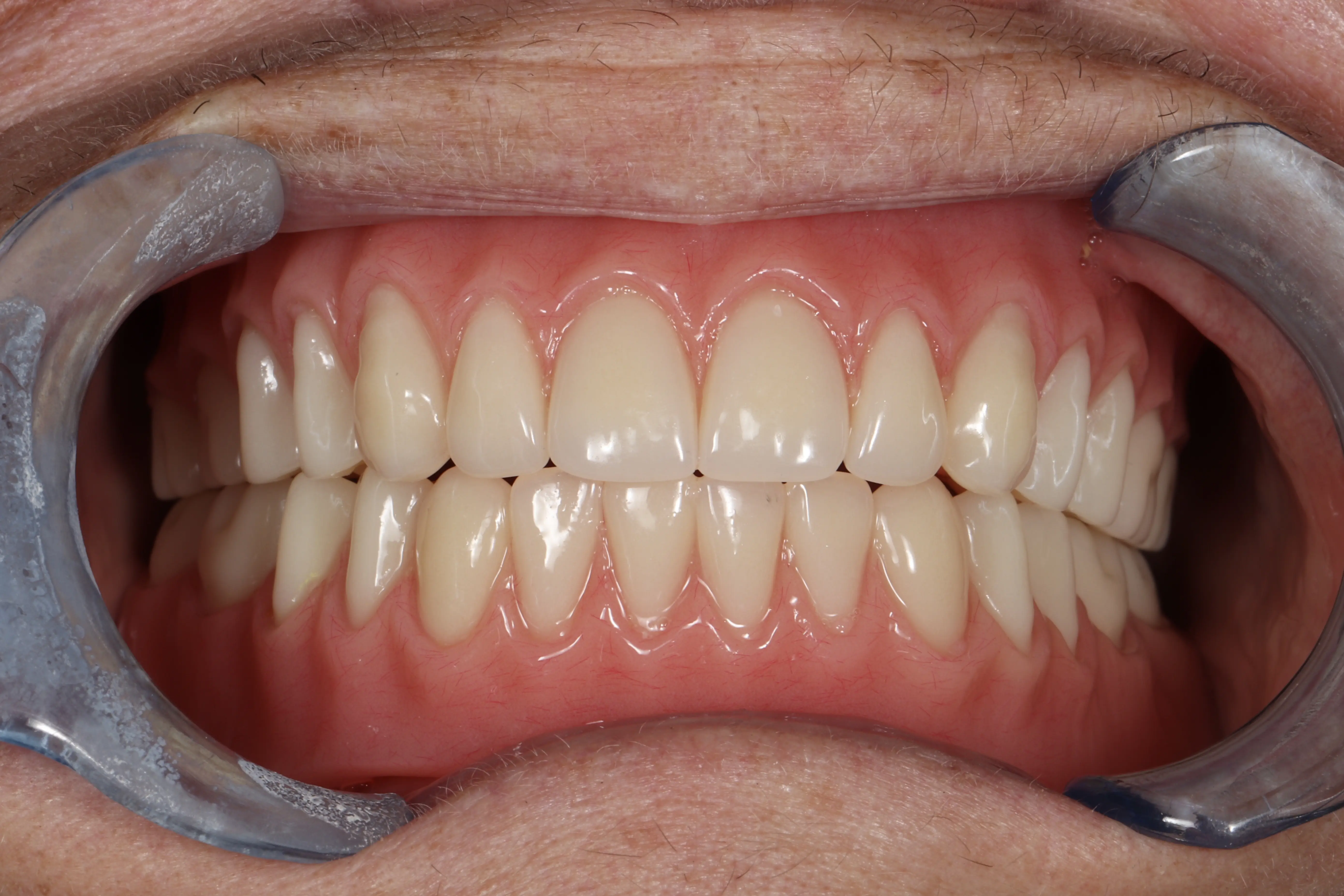 Luminous Dental - Josh George, DMD