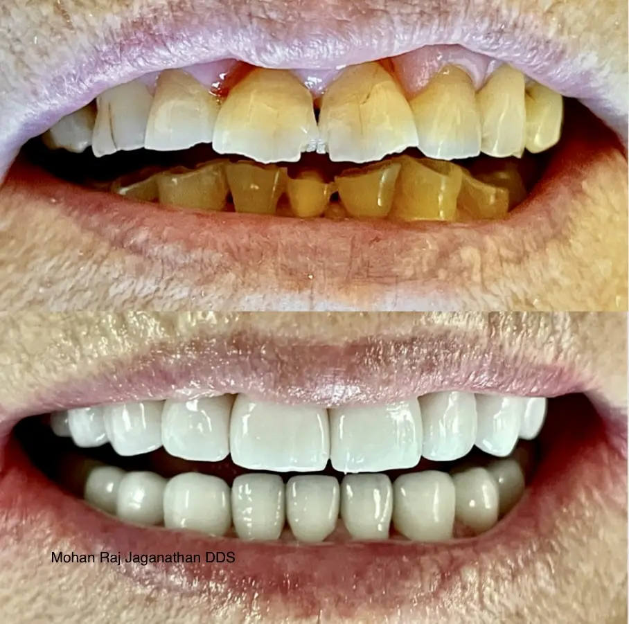 Elite Dental - Mohan Raj Jaganathan DDS & Veena Raja DDS PhD