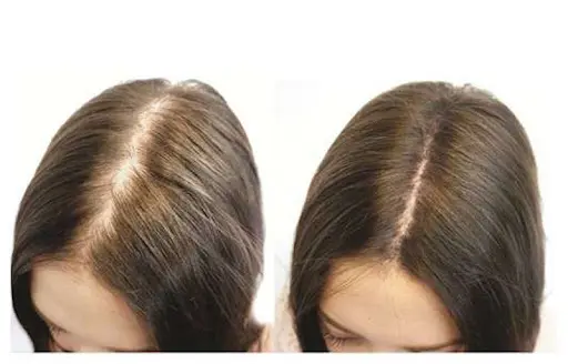Trichologist NYC - Expert Hair & Scalp Care