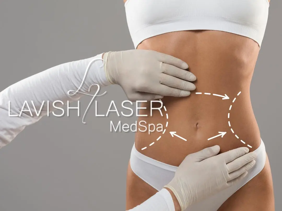 Lavish Laser Med Spa