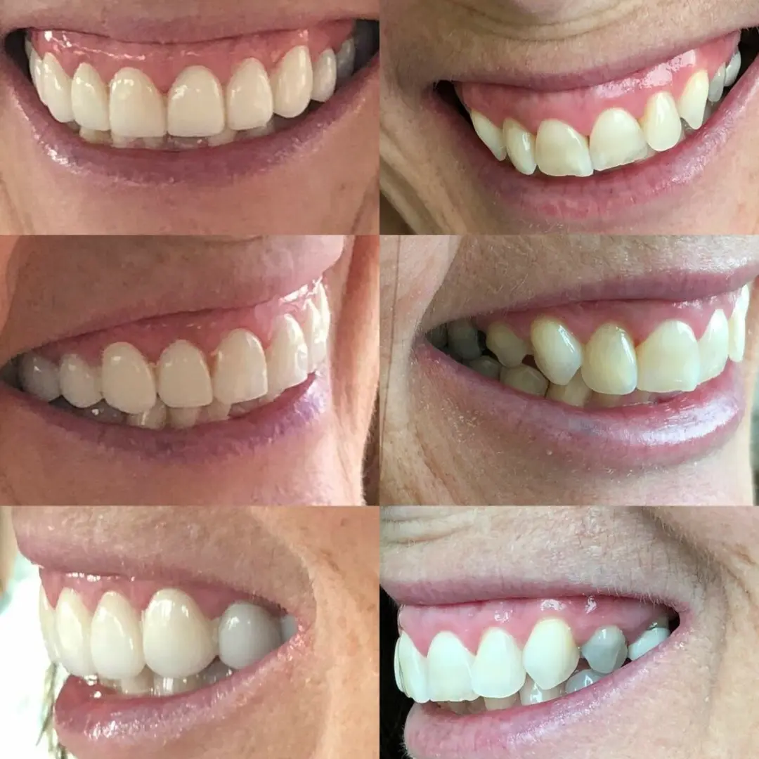 Hall Dental