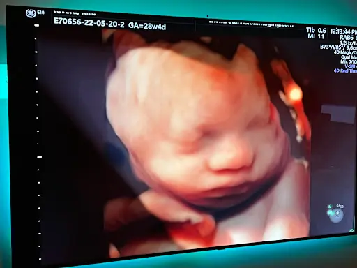 Fetal Vision Imaging