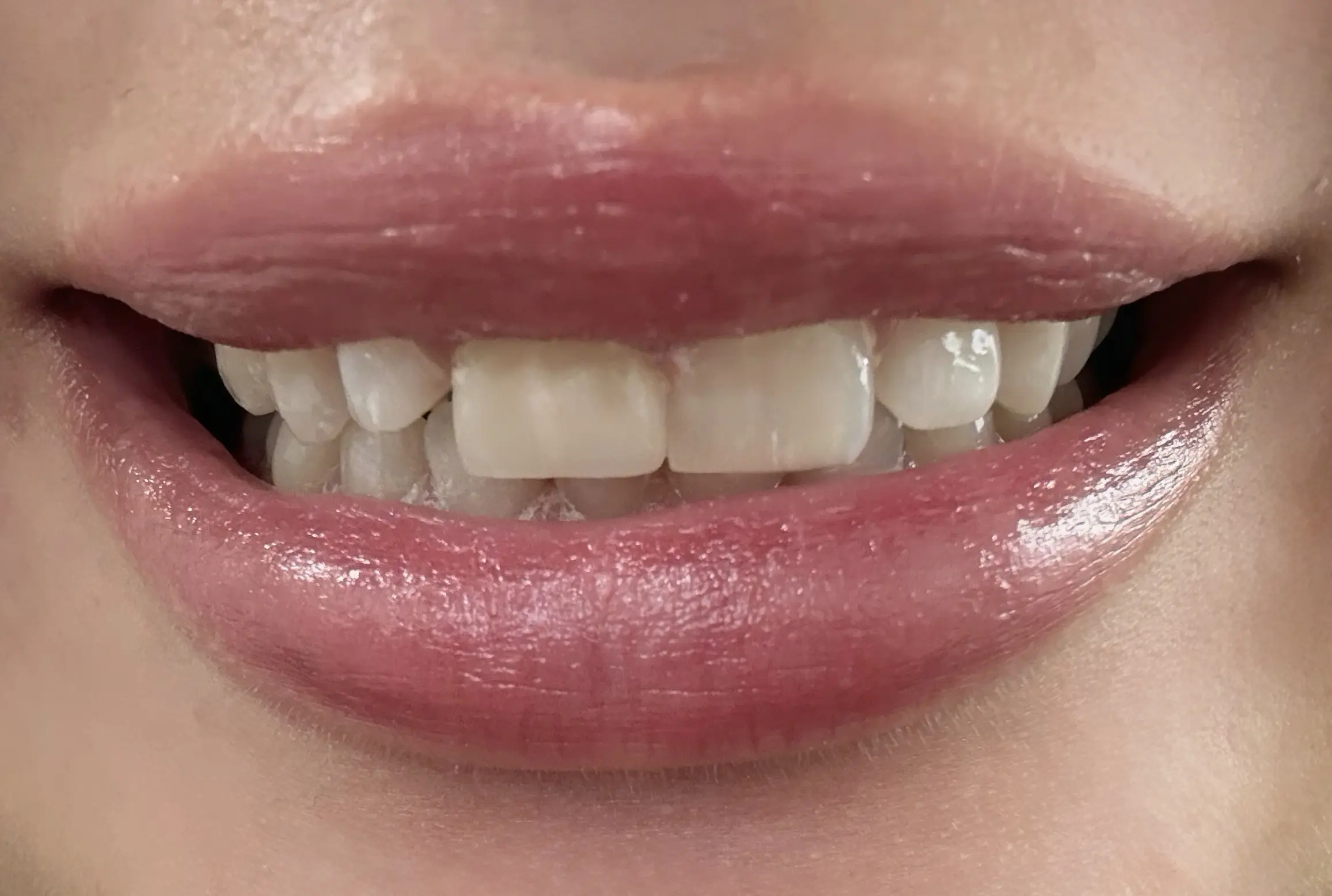 Hildebrand Family Dental Care
