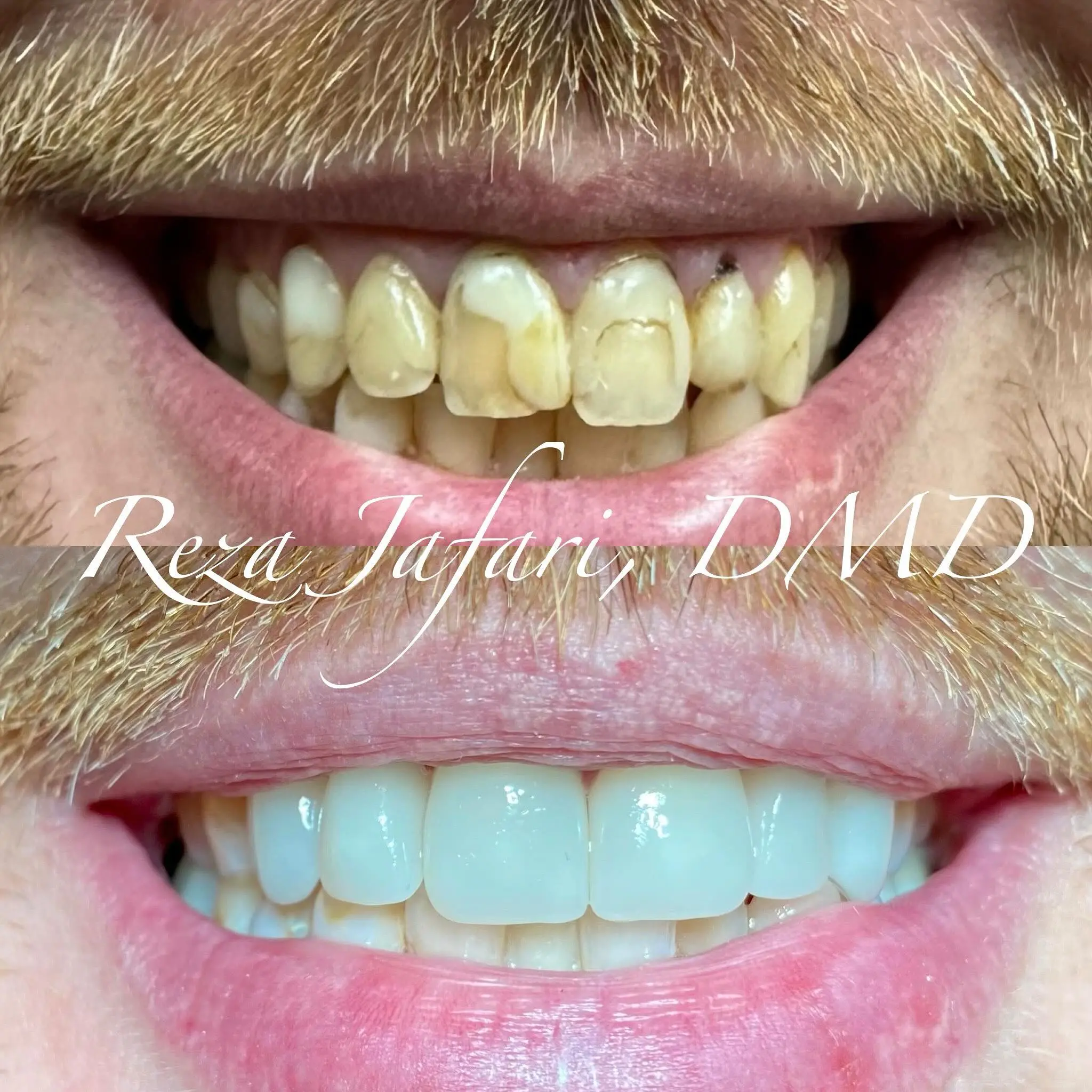 Bell Road Dental Care of Phoenix