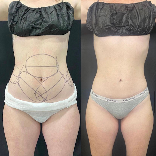 It's A Secret Med Spa - Austin