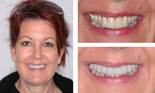 Adult Dentistry of Ballantyne