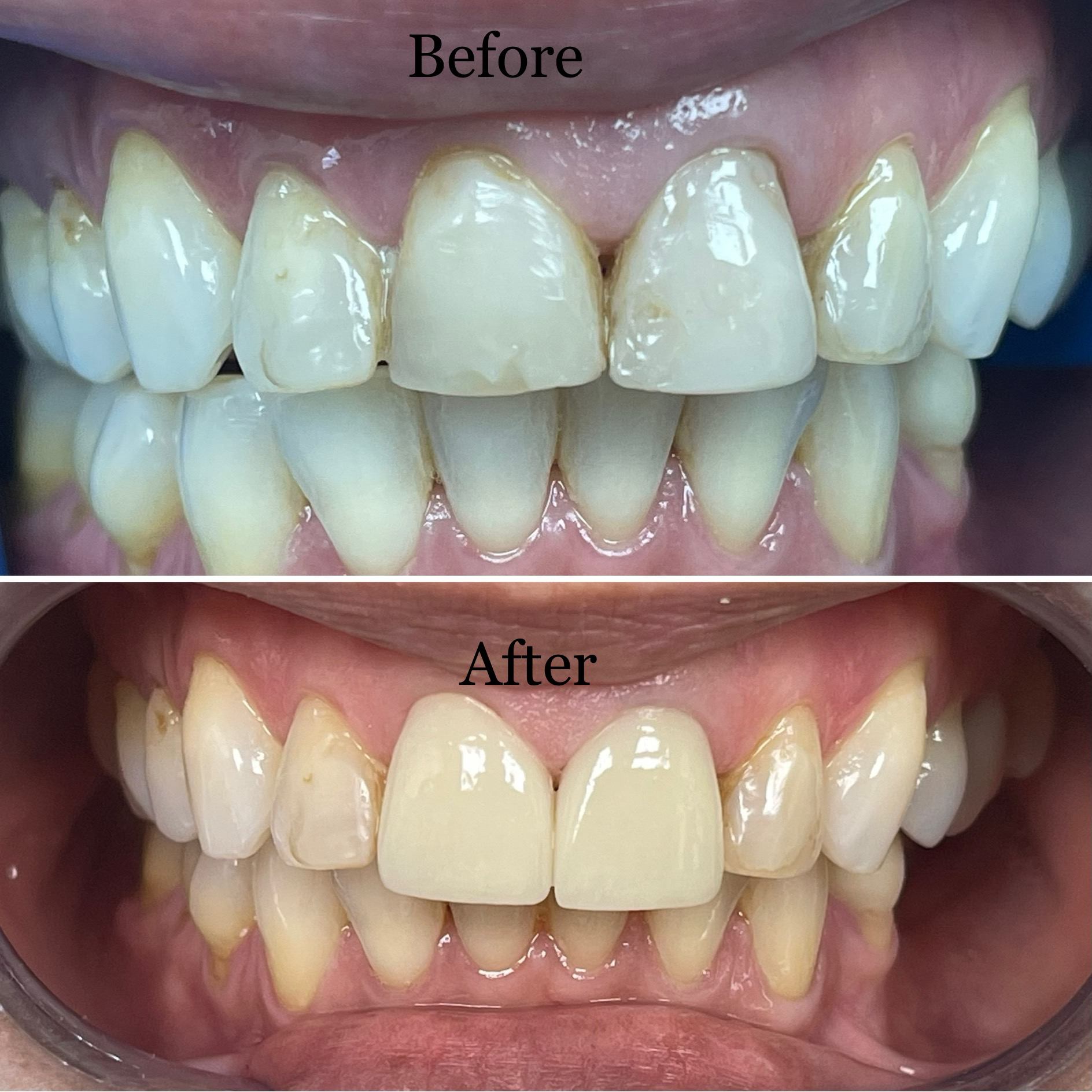 Brook Hollow Family Dentistry