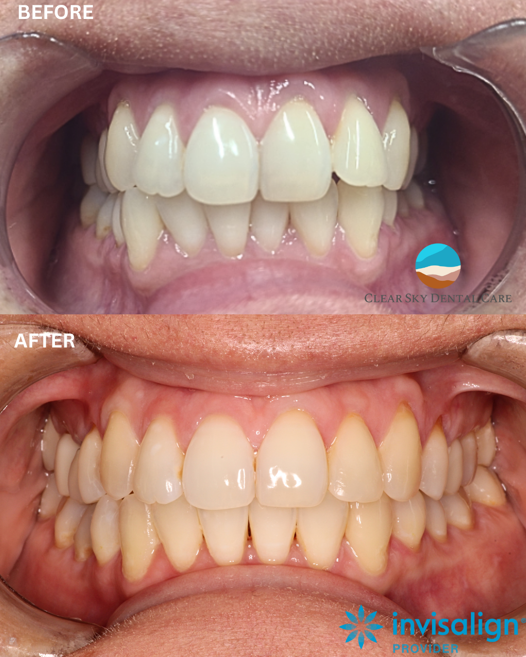 Clear Sky Dental Care Phoenix