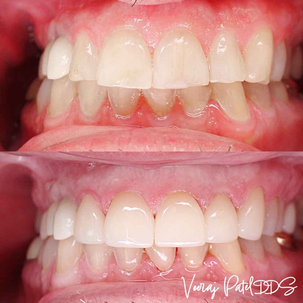 Dr. Veeraj Patel DDS