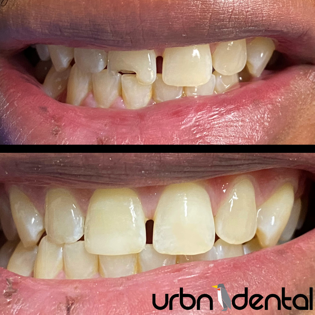 Emergency Dentist in Houston | Midtown