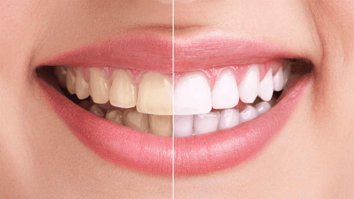 Gloss Dental - San Antonio