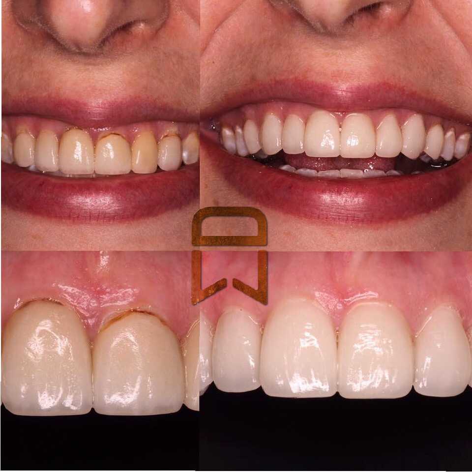 Lineberger Dentistry