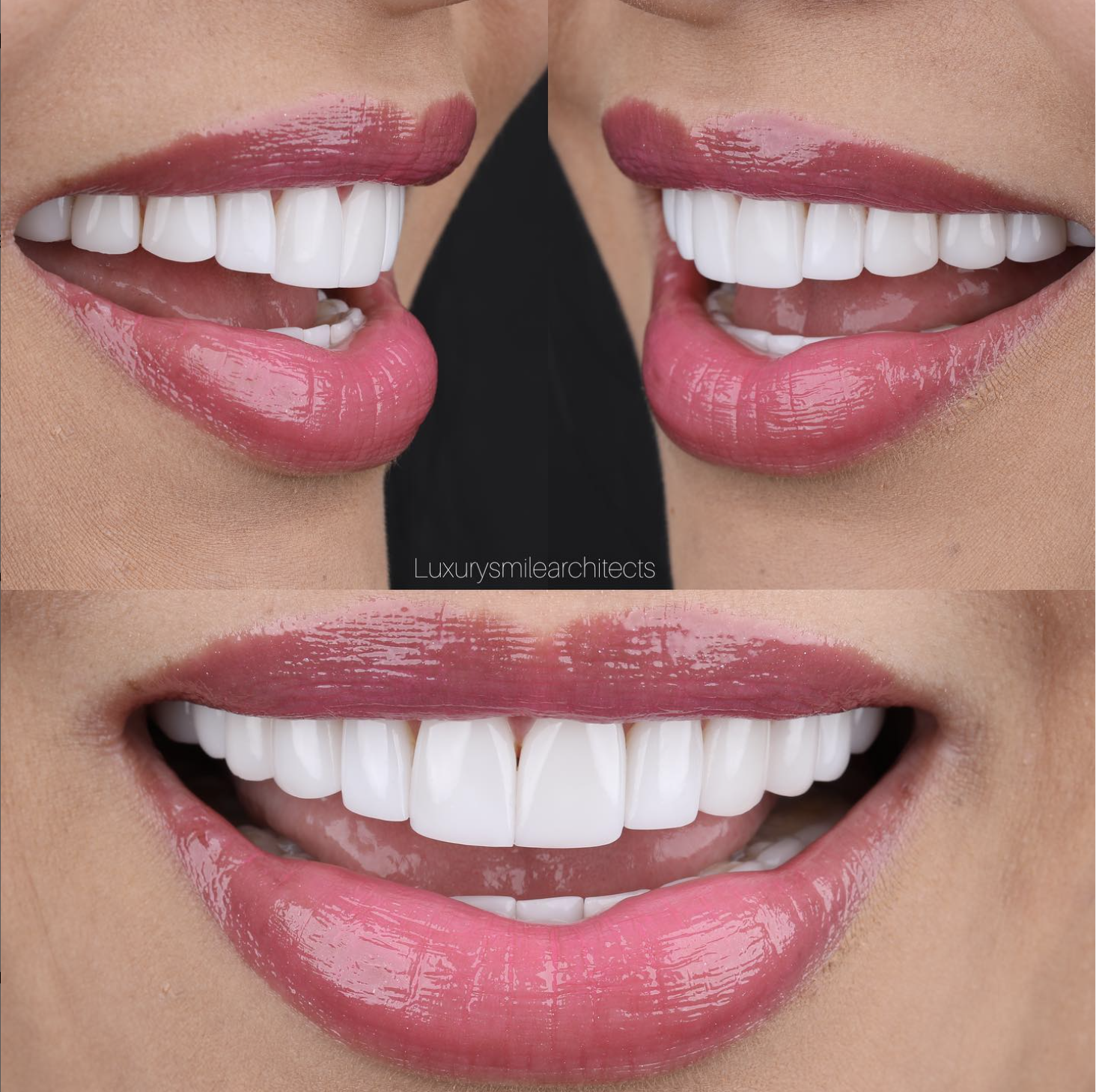 Luxury Smile Architects | Smile design Miami