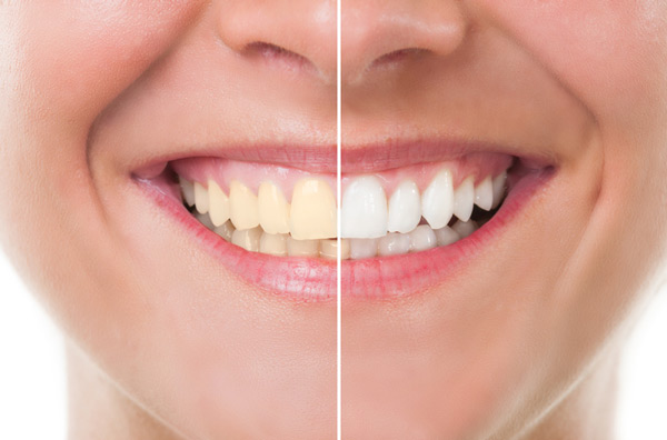Myers Park Dental Partners