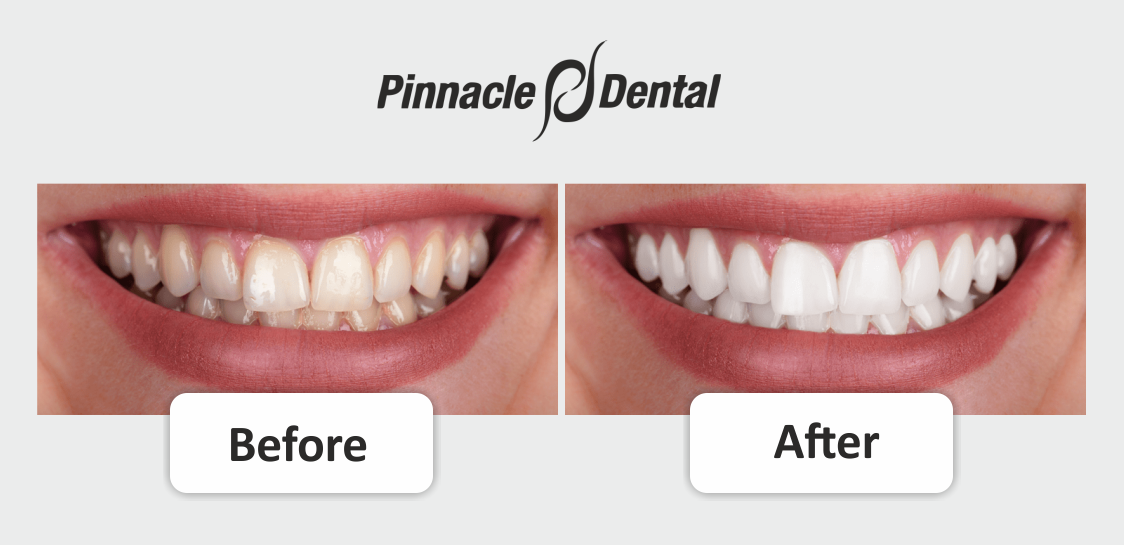 Pinnacle Dental - Dentist in Plano