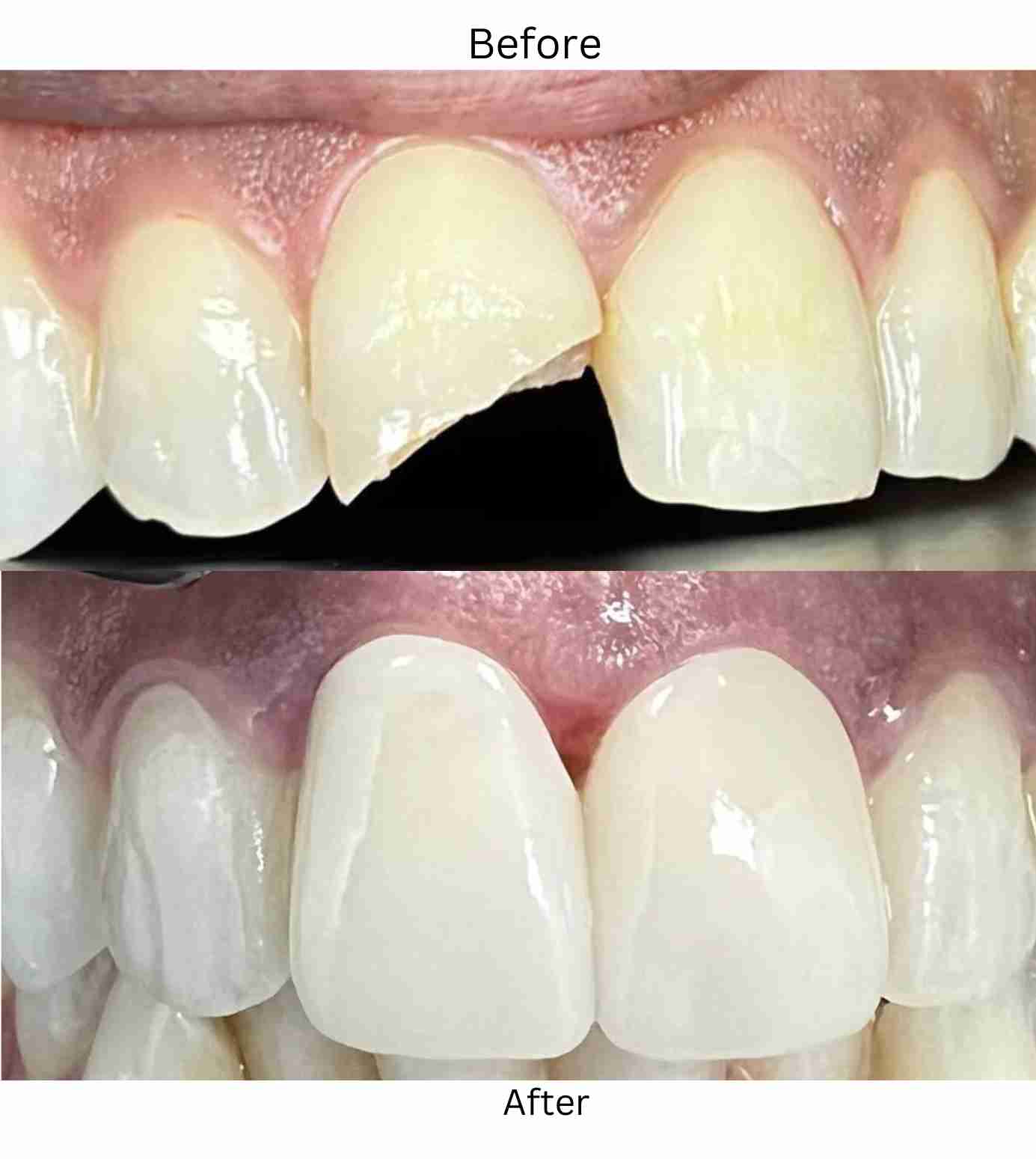 Premium Dental Charlotte