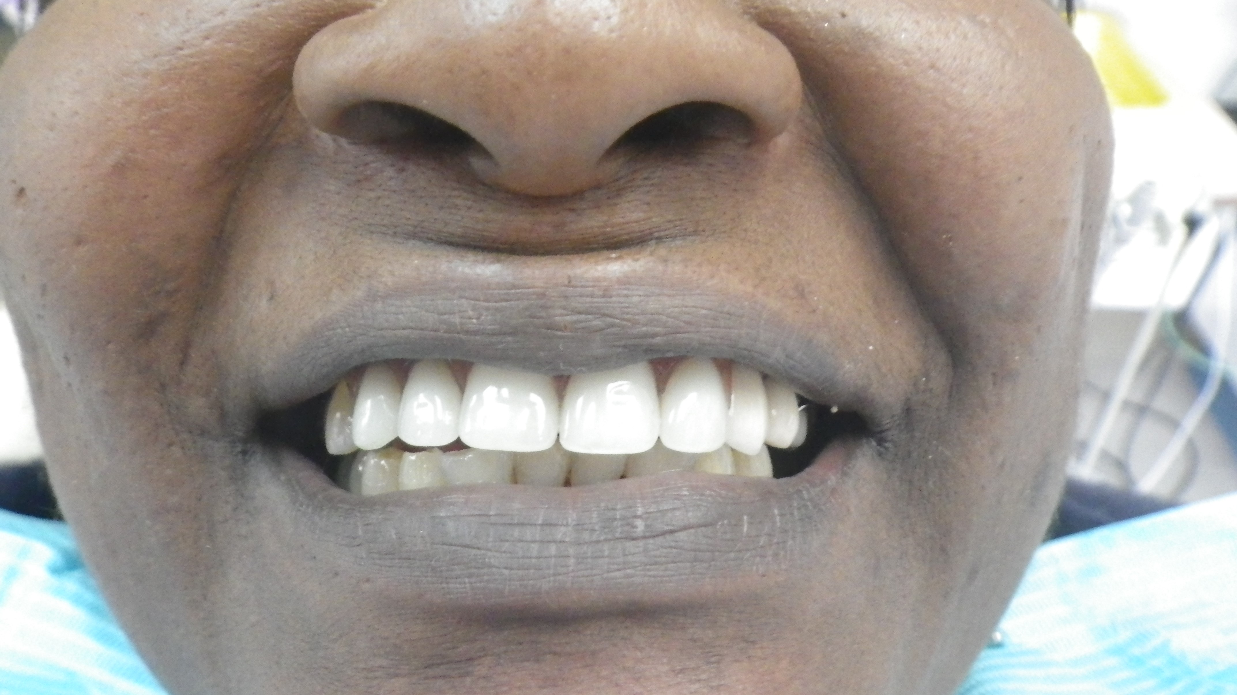 Prima Smiles (formerly Yeung Smiles)