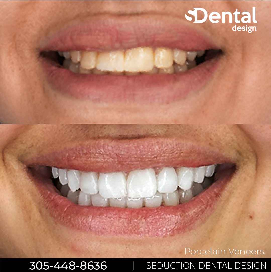 Seduction Dental Design