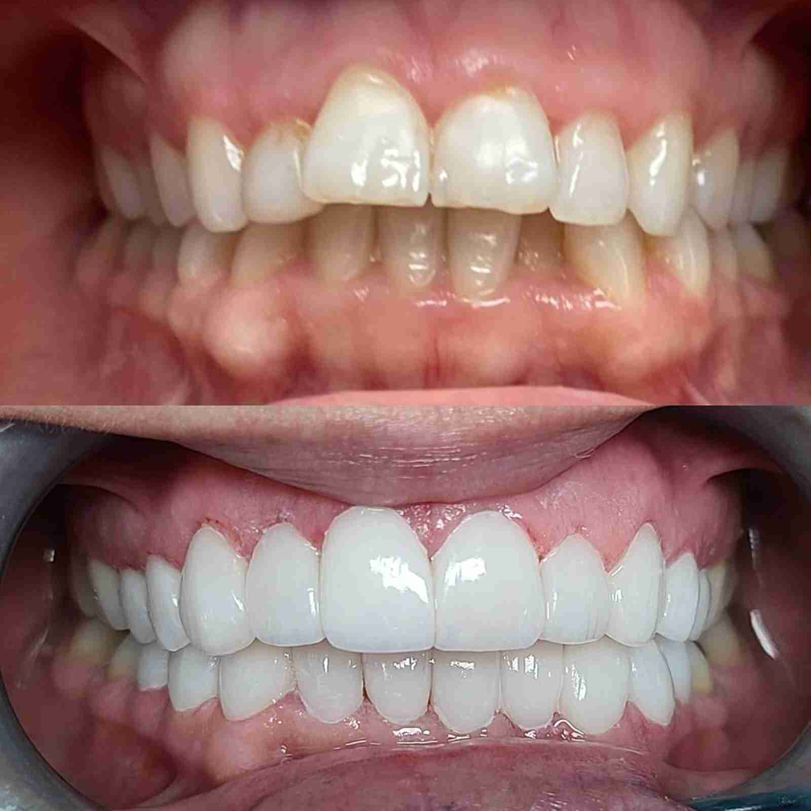 Smile Design Miami