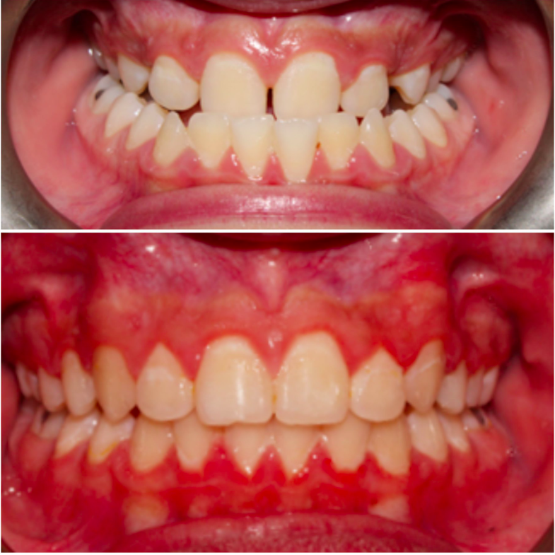 Smiles Today Dental Las Vegas