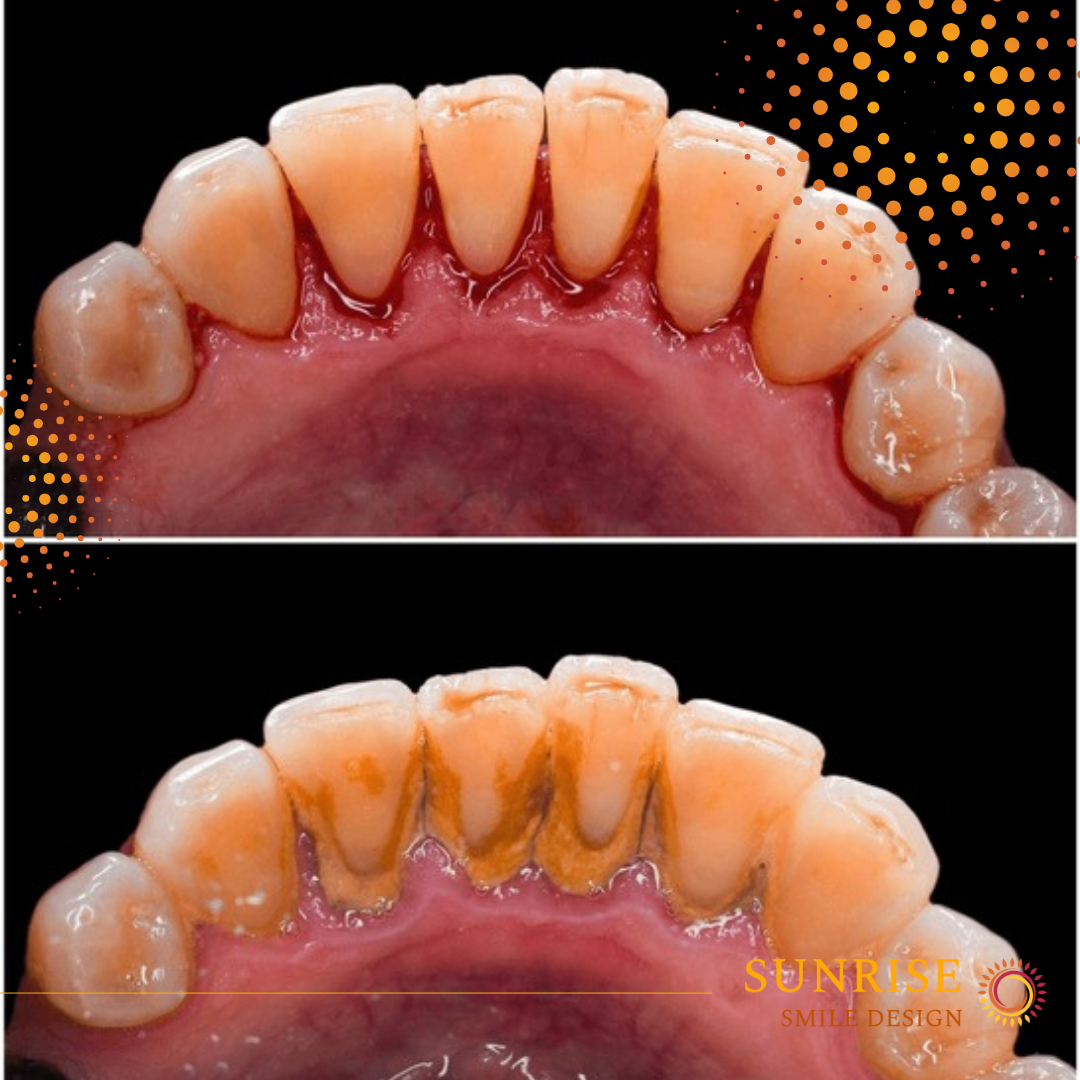 Sunrise Smile Design: Rick Campbell, DDS