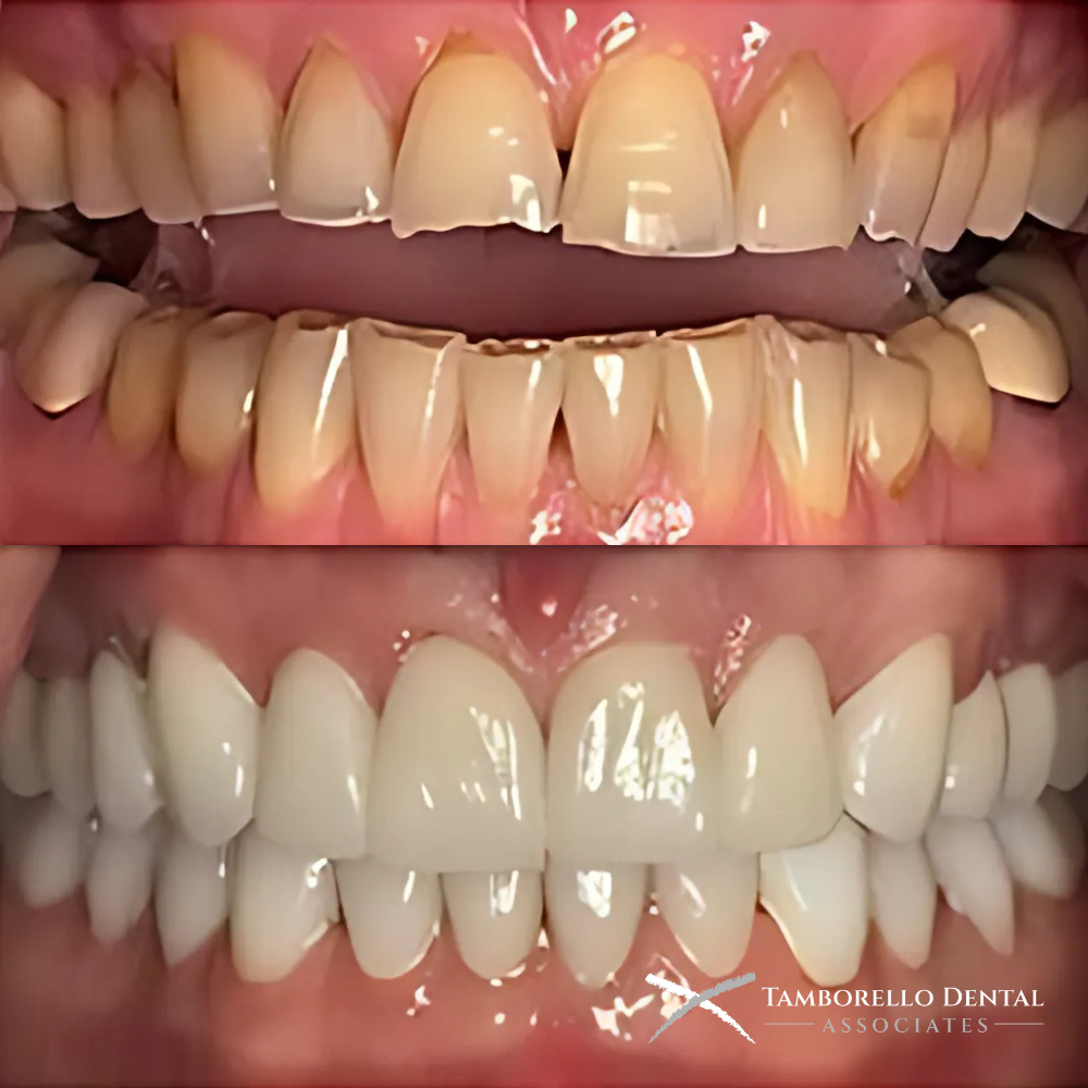 Tamborello Dental Associates