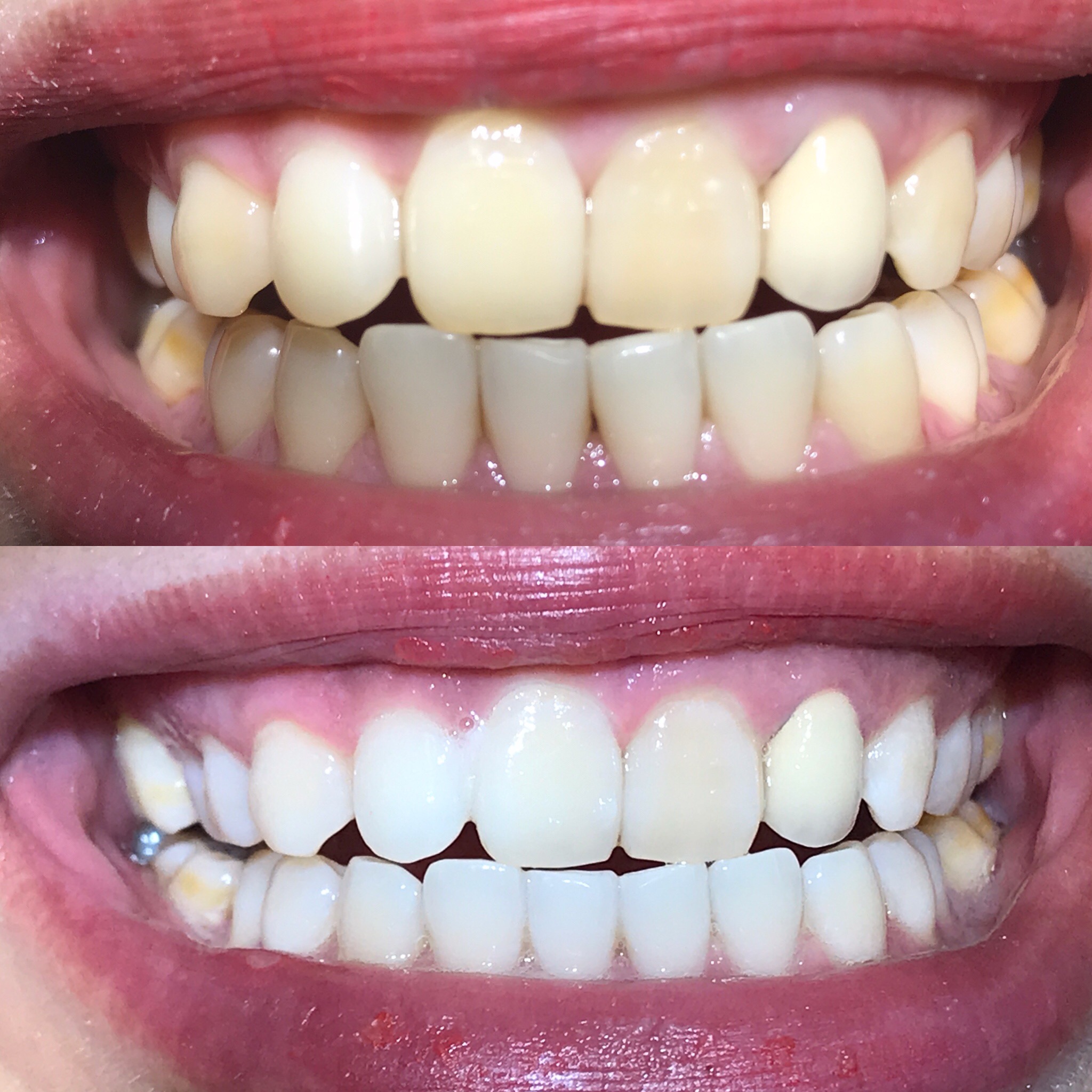 Yorktown Dental Spa Houston Galleria