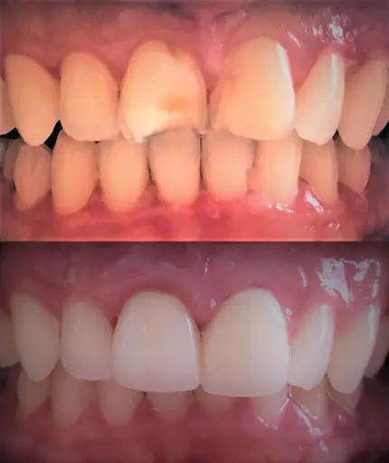 Grand Oaks Dentistry